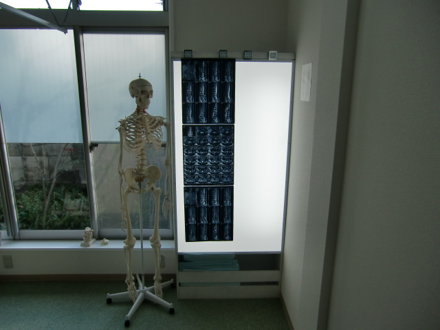 シャーカッセン